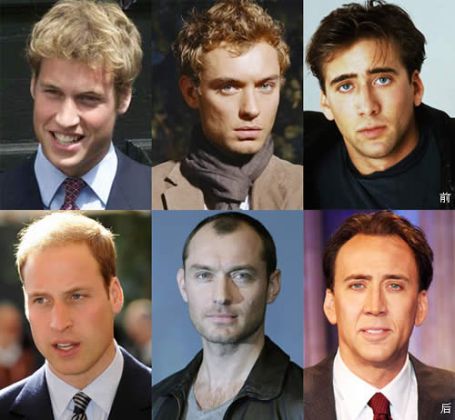 【圖】【推薦】20種減少脱髮的方法