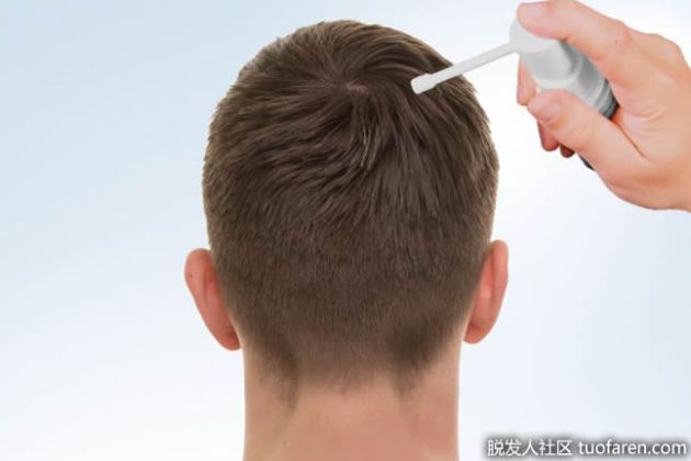 【圖】米諾地爾簡介