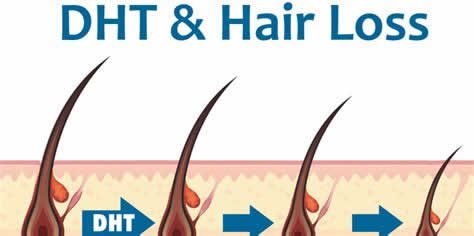 【圖】DHT脱髮的抑制食物有哪些