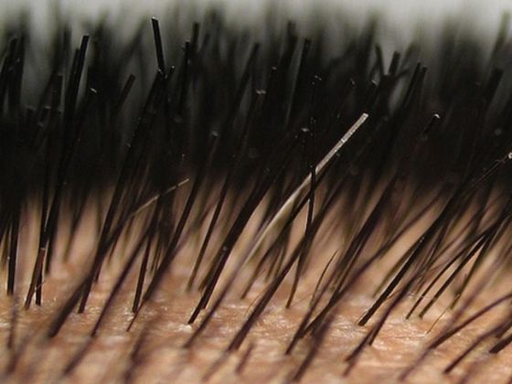 【圖】什麼是導致頭皮乾燥的原因?