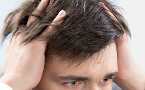 【圖】治療頭髮生長的6種方法