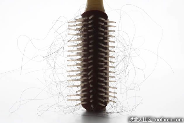 【圖】頭髮稀少怎麼辦？3個小秘訣教你應對難題