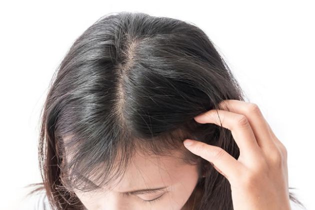 【圖】頭皮發癢的原因是什麼?