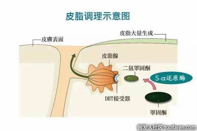 【圖】5α-還原酶的作用