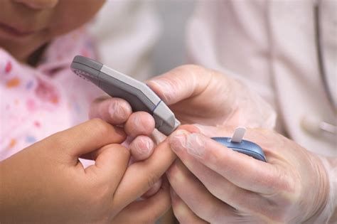 【圖】糖尿病會引起脱髮嗎