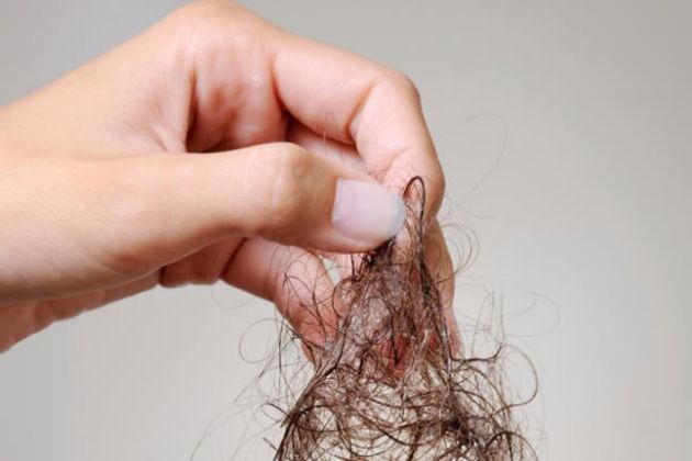 【圖】如何確定最佳的脱髮治療方法