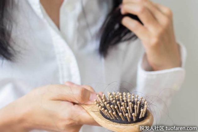 【圖】女性禿頭的原因