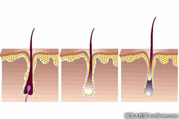 【圖】休止期脱髮簡介