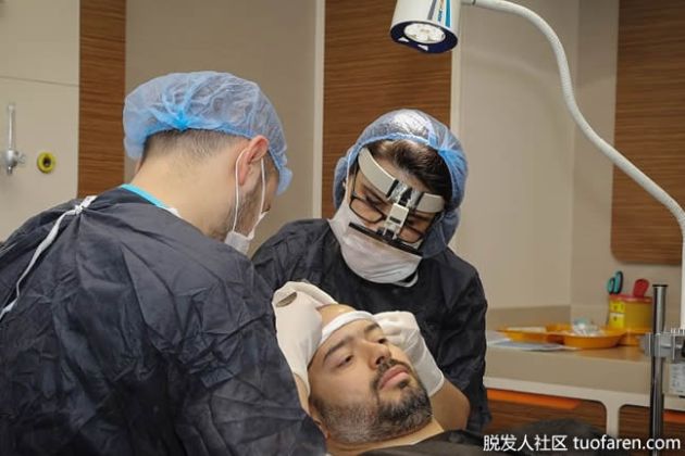 【圖】頭髮移植是怎麼做的？