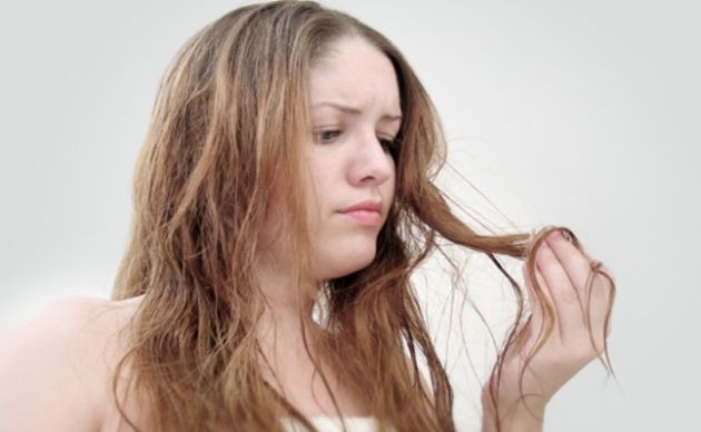 【圖】如何逆轉頭髮稀疏