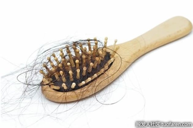 【圖】雌激素與女性脱髮的關係