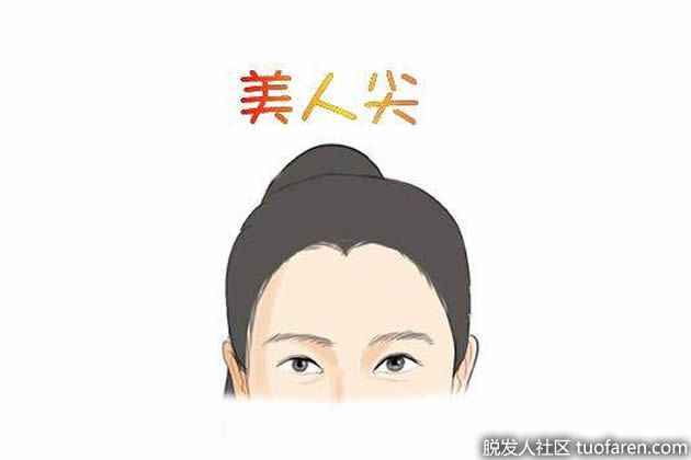 【圖】美人尖種植的過程及效果分析