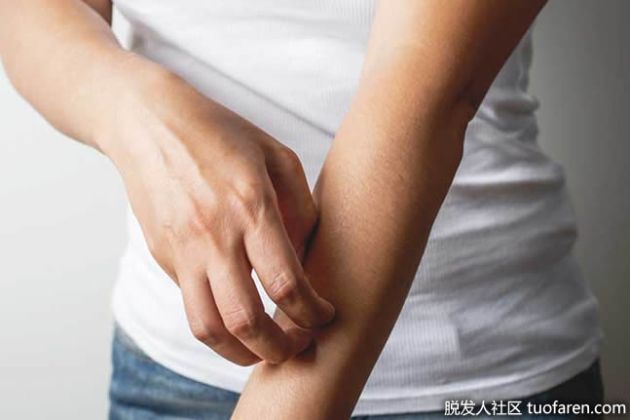 【圖】皮膚有螞蟻爬行的感覺是什麼情況