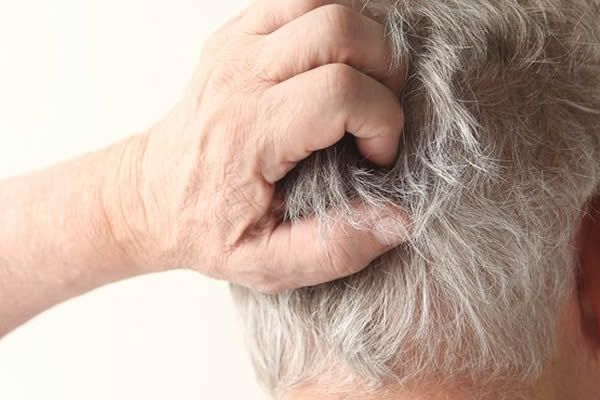 【圖】【組圖】如何去除毛蟎