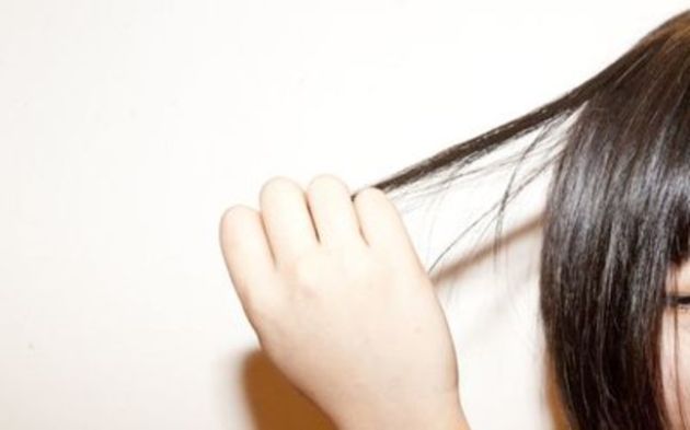 【圖】頭髮疾病有哪些？