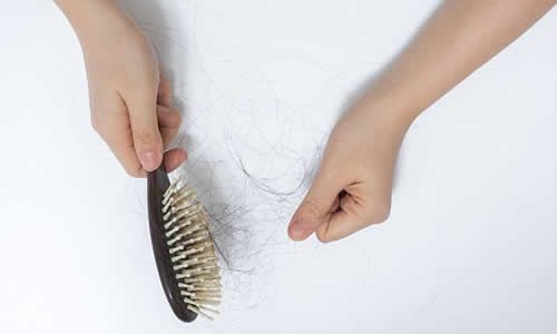 【圖】頭髮稀少的原因 頭髮稀少怎麼辦才好