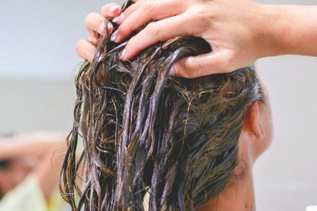 【圖】治療頭皮屑的最佳家庭療法