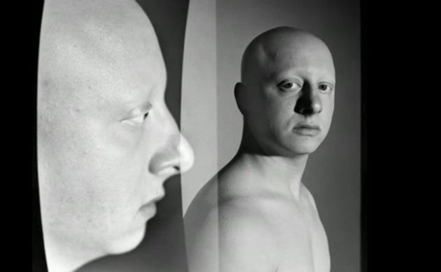 【圖】什麼是全禿?