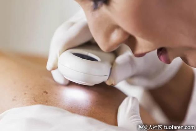 【圖】癤子的病因和治療方法是什麼？