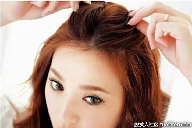 【圖】掉幾根頭髮算脱髮？