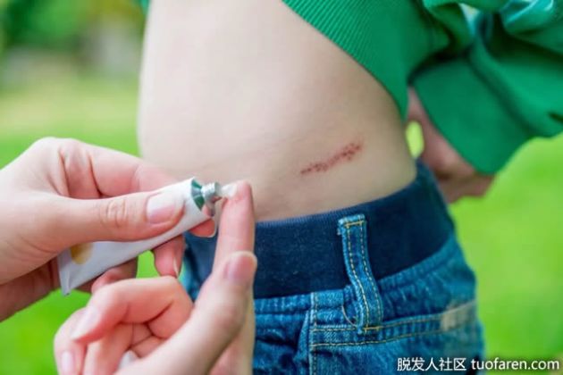 【圖】什麼是維生素K氧化物？