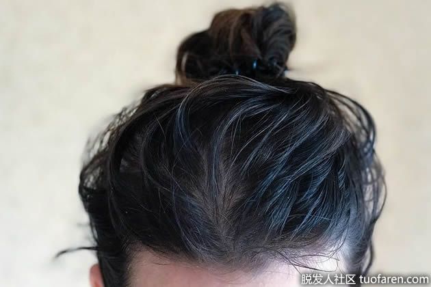 【圖】【組圖】快速簡單的方法修復油性頭髮