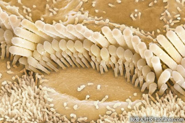 【圖】喉嚨裏的毛髮叫什麼？