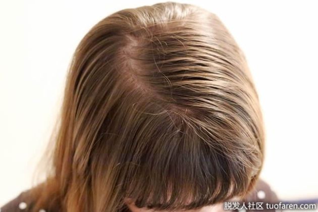 【圖】為纖細、稀薄、油性頭髮提供的護髮秘訣