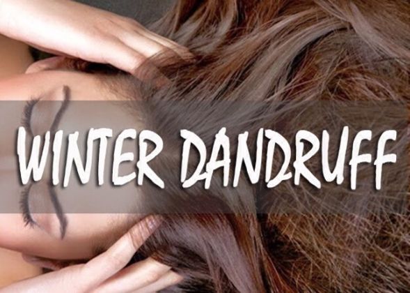 【圖】什麼是冬季頭皮屑?
