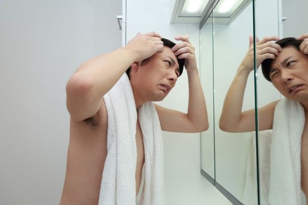 【圖】如何選擇最佳的斑禿洗髮水?