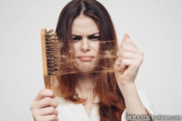 【圖】脱髮並不是世界末日