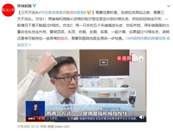 【圖】拉發測試：你是否存在脱髮危機?