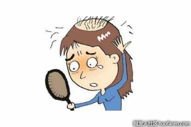 【圖】頭髮加密的特點，你知多少？