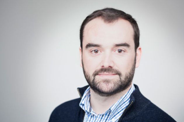 【圖】前額脱髮治療