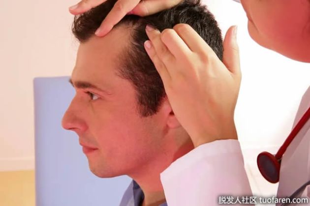 【圖】什麼樣的醫生治療脱髮？