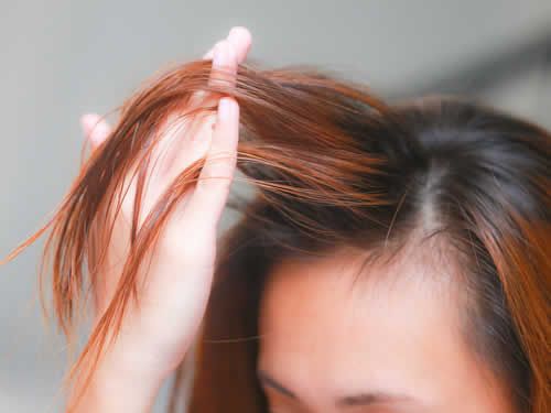 【圖】刺激頭髮生長的自然療法