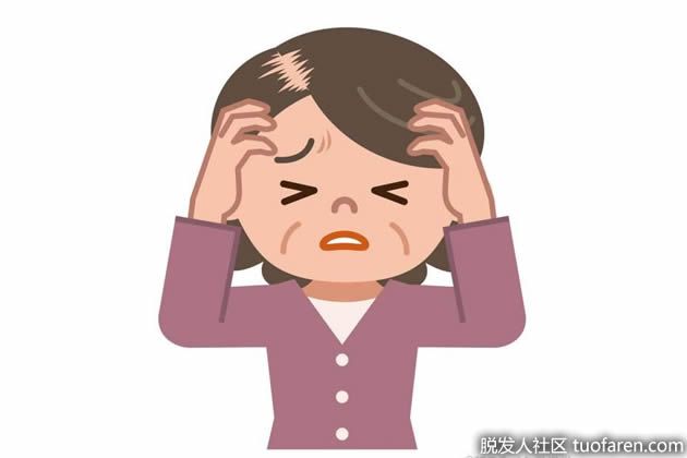 【圖】頭髮的常見問題是什麼