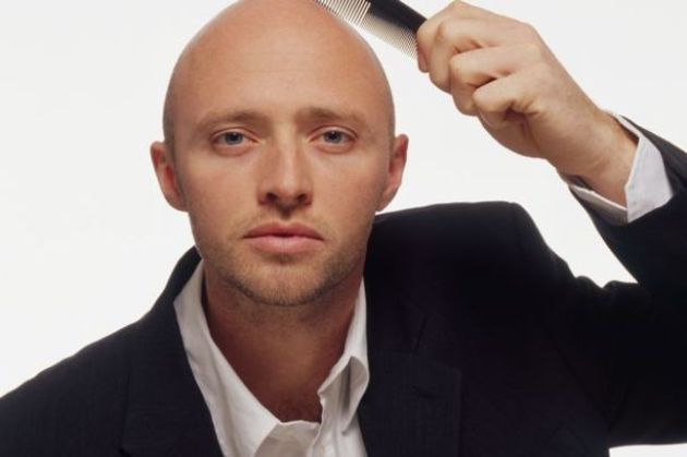 【圖】有治療禿頂的藥嗎？