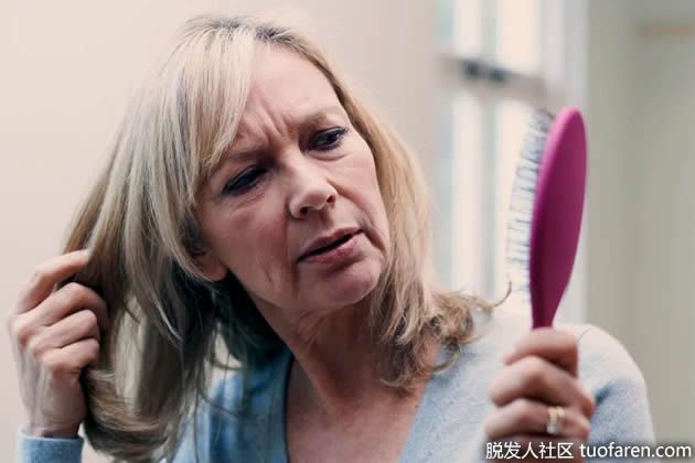 【圖】鋸棕櫚對脱髮有作用嗎？