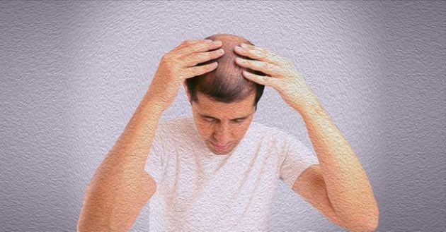 【圖】休止期脱髮的七種治療方法