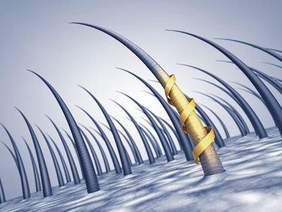 【圖】DHT頭皮脱髮治療