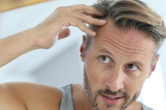 【圖】十種頭髮生長和減少脱髮的自然方法