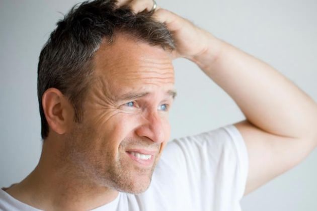 【圖】什麼是頭皮瘡？