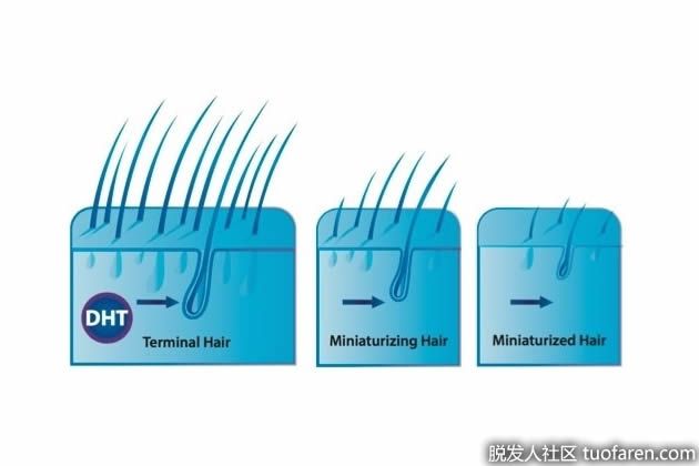 【圖】DHT是什麼意思？