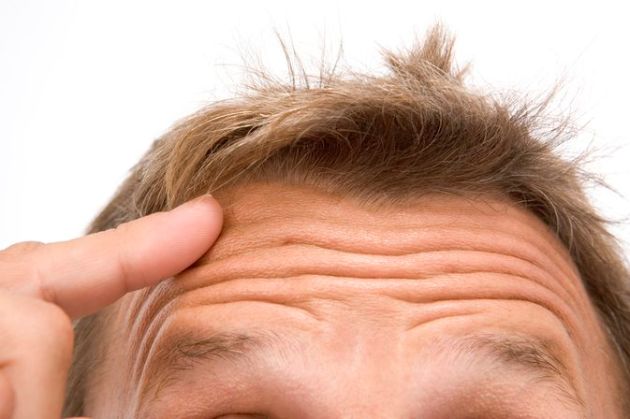 【圖】如何再生太陽穴毛髮