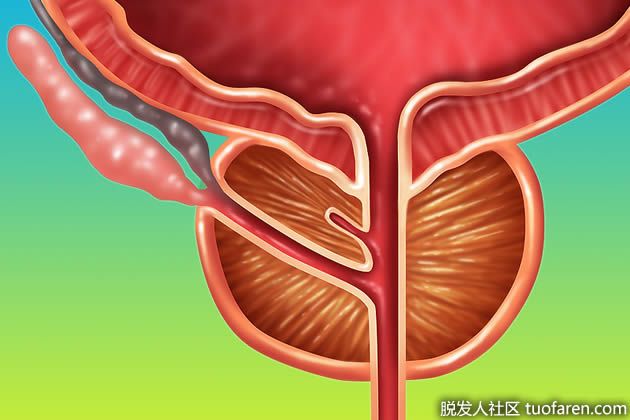 【圖】鋸棕櫚可以幫助預防前列腺癌