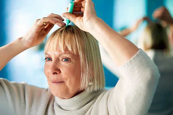 【圖】頭皮發炎有哪些治療方法？