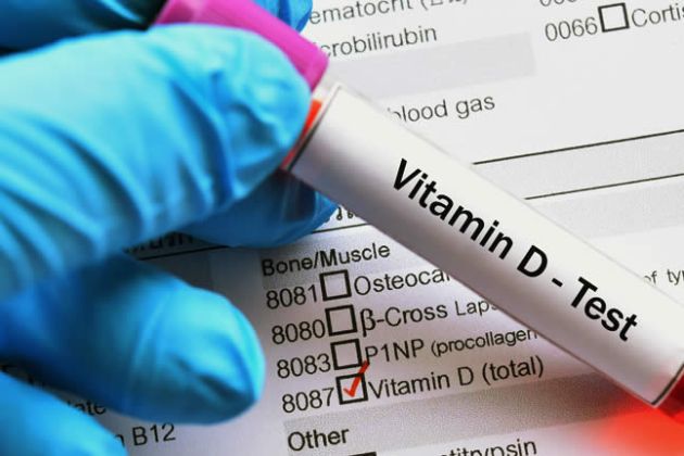 【圖】脱髮嗎?可能是維生素D缺乏