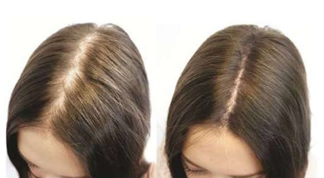 【圖】【組圖】如何使用生物素促進頭髮生長