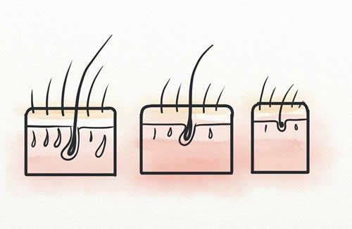 【圖】什麼是女性頭皮的天然DHT阻滯劑